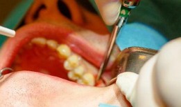 智齿完整版在线观看,揭秘青春成长的秘密与挑战